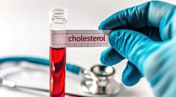 Jaki lekarz leczy cholesterol i jak uniknąć poważnych problemów zdrowotnych