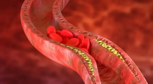 Cholesterol 240 czy to dużo? Sprawdź, jakie niesie zagrożenia