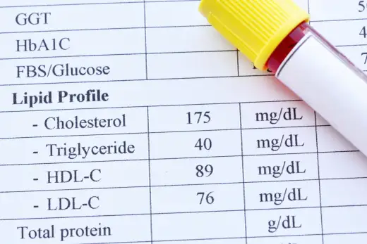 Lipidogram: Co to jest, jak się przygotować i co oznaczają wyniki?